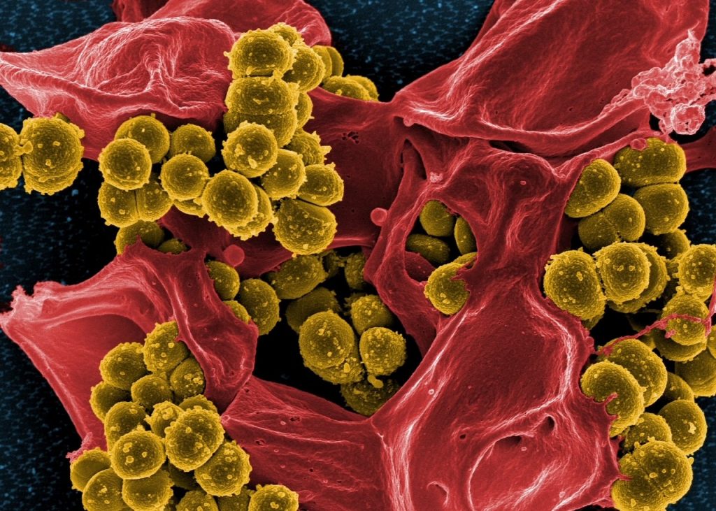 Scanning electron micrograph of methicillin-resistant Staphylococcus aureus bacteria (yellow) and a dead human white blood cell (coloured red) 