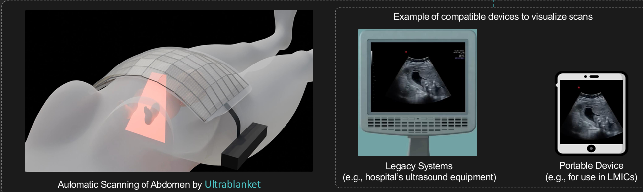 Ultrablanket